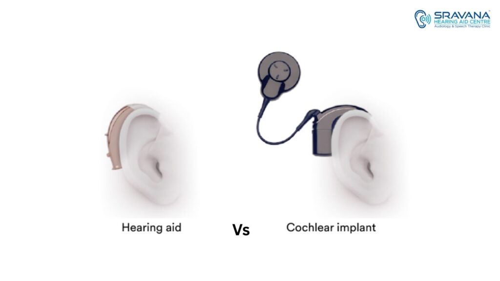 Bone-Anchored Hearing Aid vs Cochlear Implant