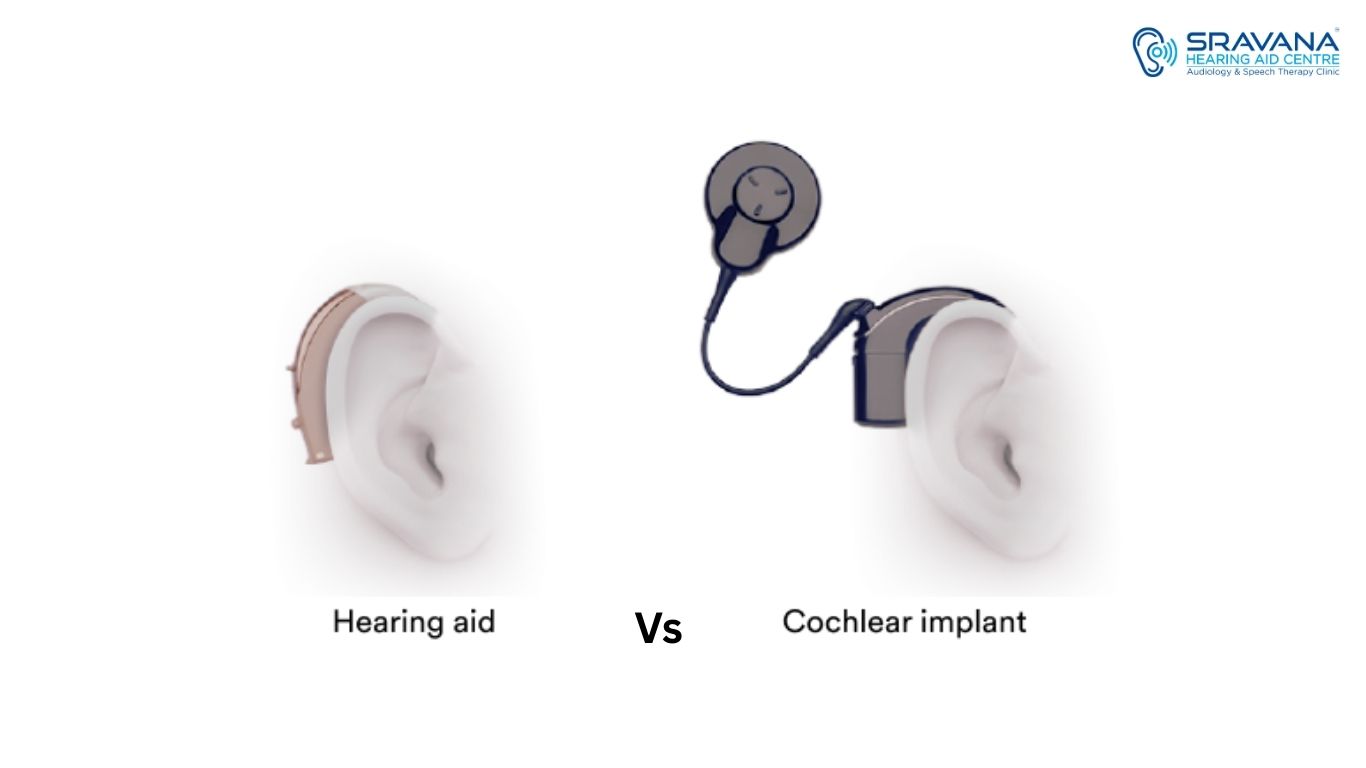 Bone-Anchored Hearing Aid vs Cochlear Implant